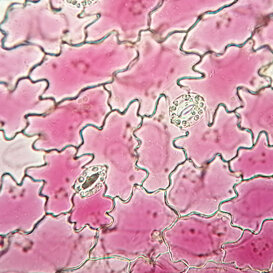 Cellule di radicchio e vacuoli con antociani Cellule di radicchio e vacuoli con antociani